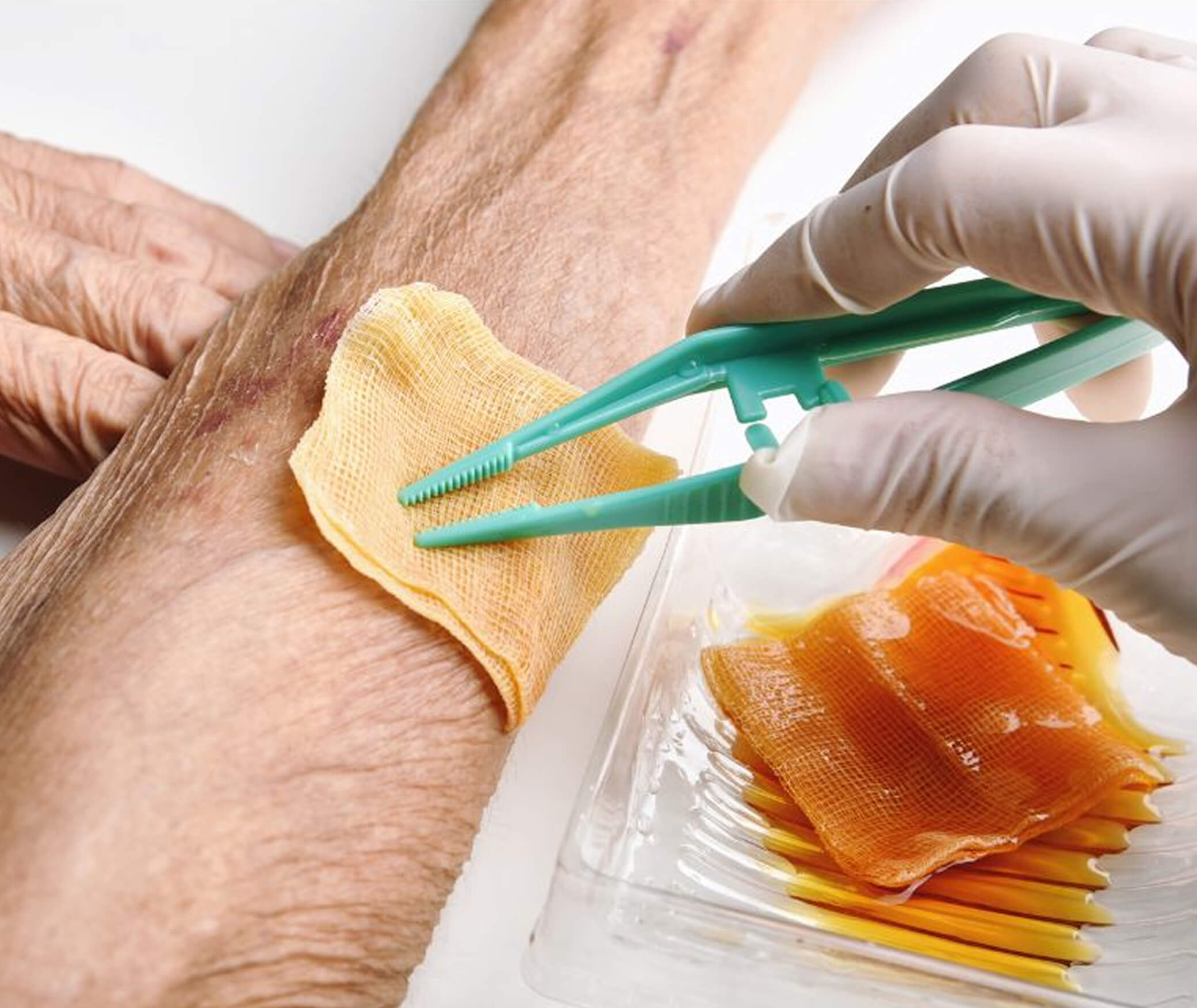 Wound Care